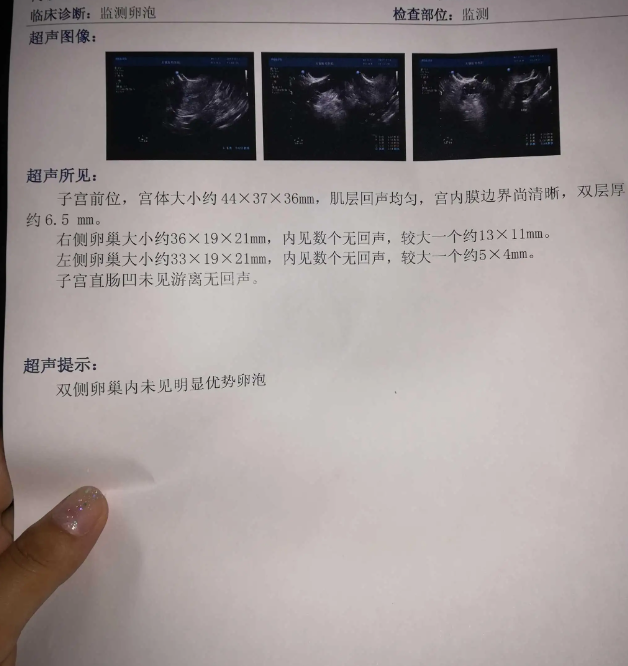 卵泡检测单